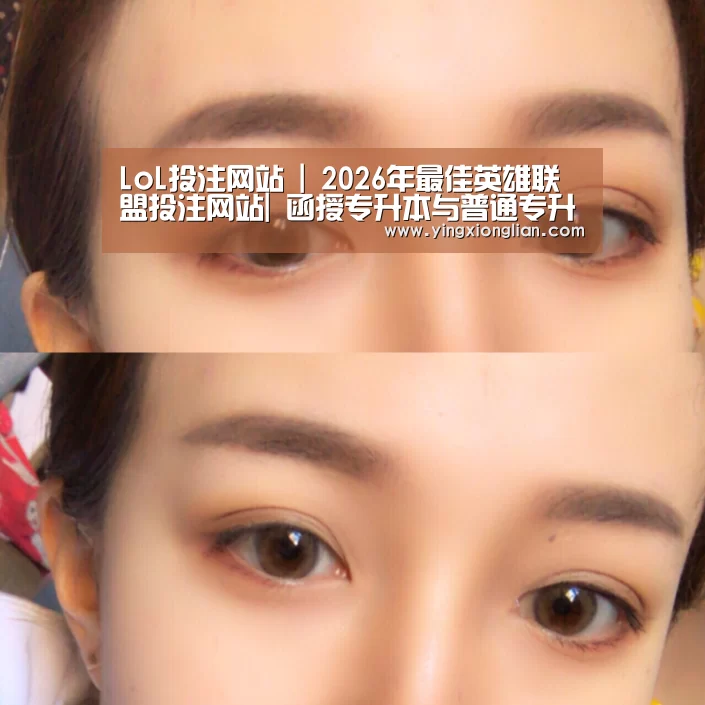 LoL投注网站 | 2026年最佳英雄联盟投注网站